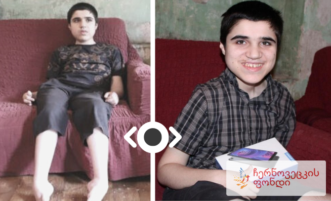 The boy who cannot walk now flies with happiness!